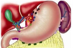 胆中危机（中）