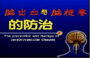 脑出血与脑梗塞的防治