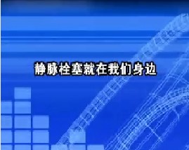 静脉栓塞就在我们身边