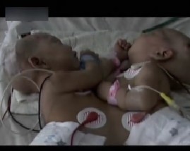 百科探秘-生命的切割线（上）