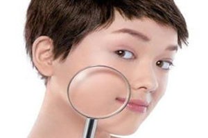 皮肤过敏巧应对