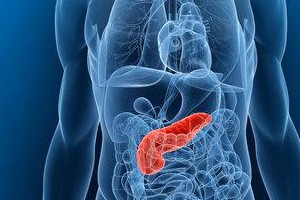 生死胰腺牵（上）