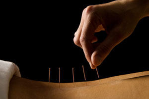 中医妙招解疼痛（上）