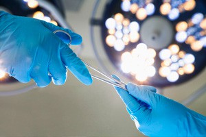 腹腔镜下卵巢癌全面分期术 全子宫双附件切除（一）