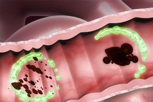 康复护理技术操作规程膀胱容量和压力测定及残余尿量测定技术 肠道康复护理训练技术